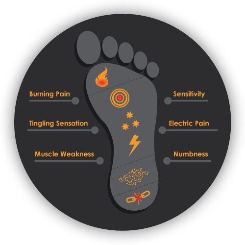 Chiropractic Newhall IA Neuropathy Foot